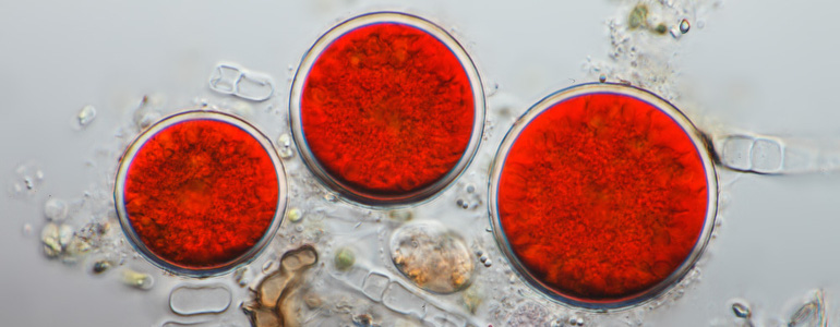 Astaxanrhin Microalge - Astaxanthin Wirkung, Anwendung und Erfahrungen